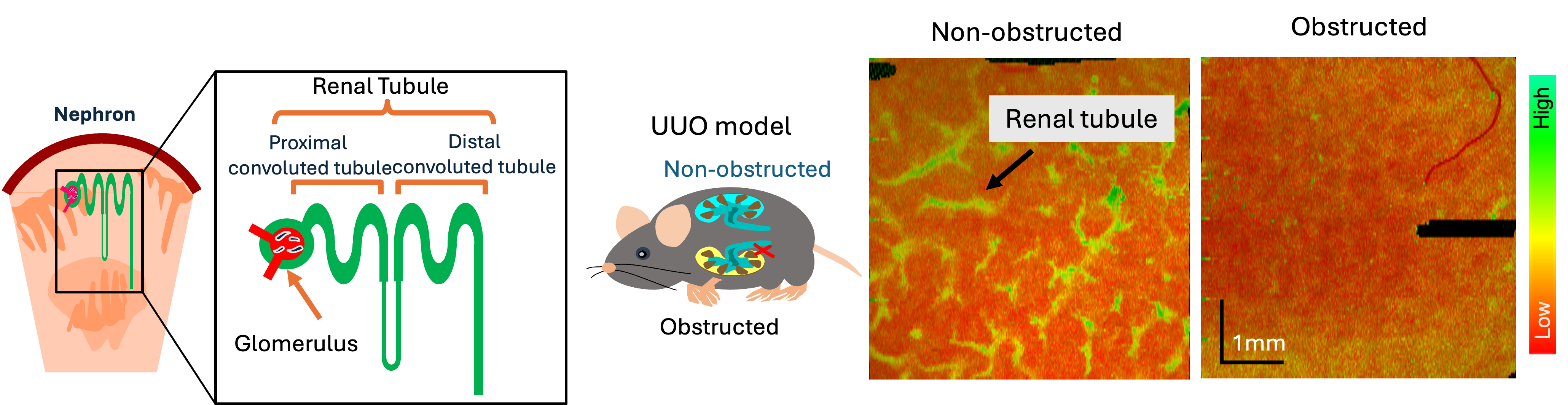 Renal tubule results